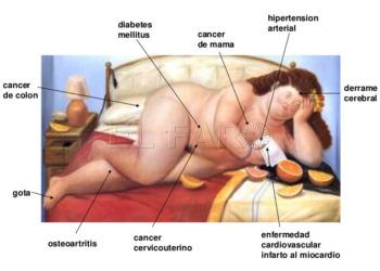 20190717-obesidad-doctor-avila-1