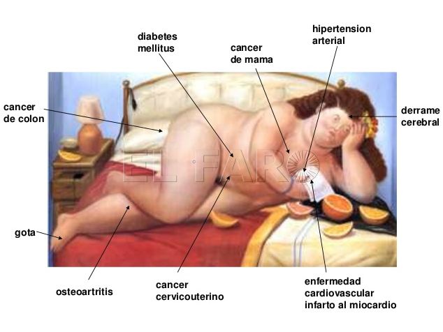 20190717-obesidad-doctor-avila-1
