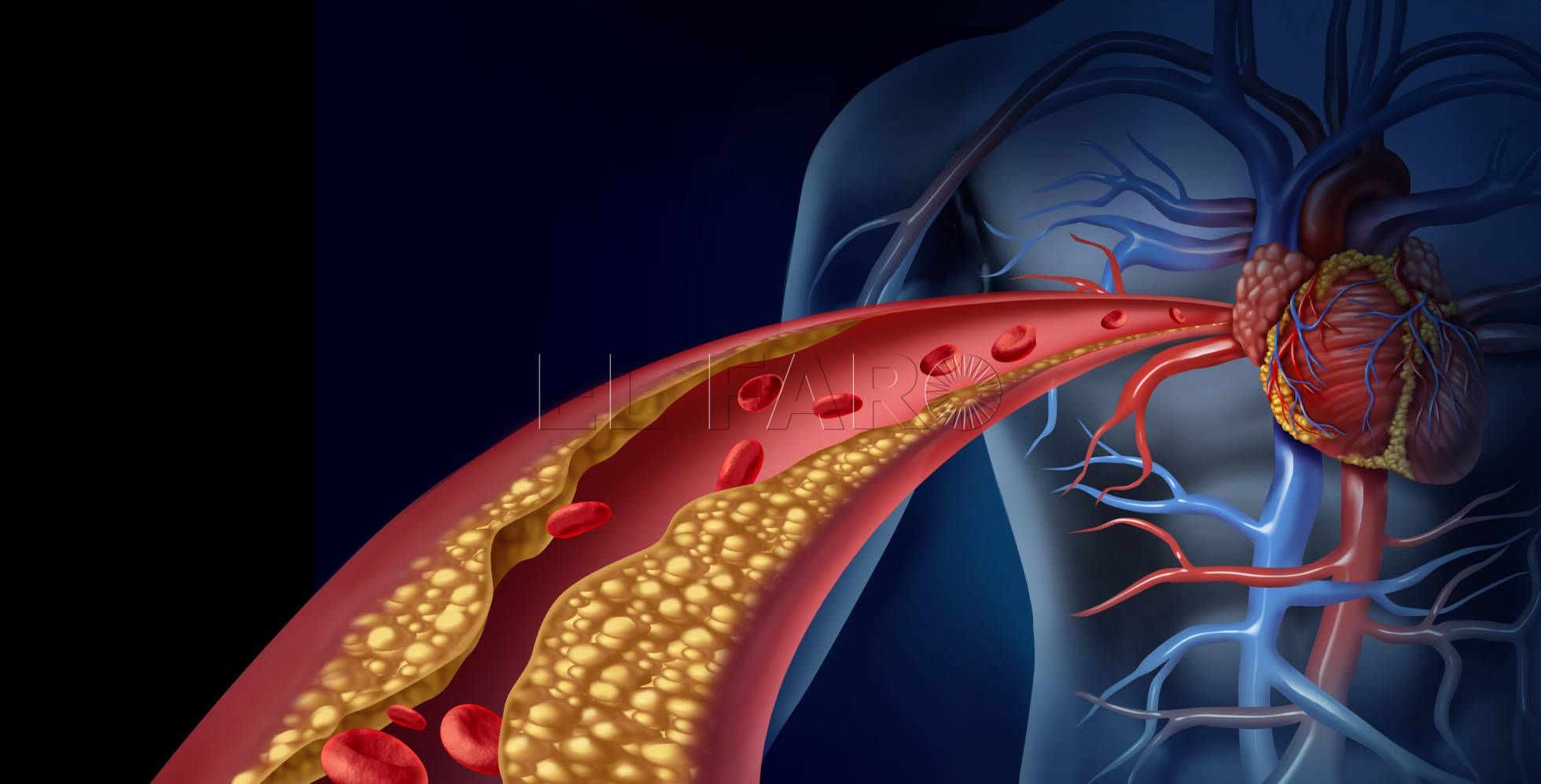 sindrome-metabolico-3
