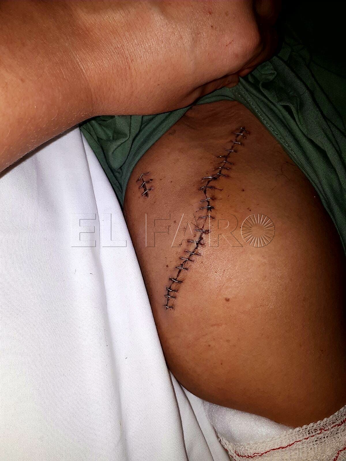 ismael-dedarbi-policia-accidente-1