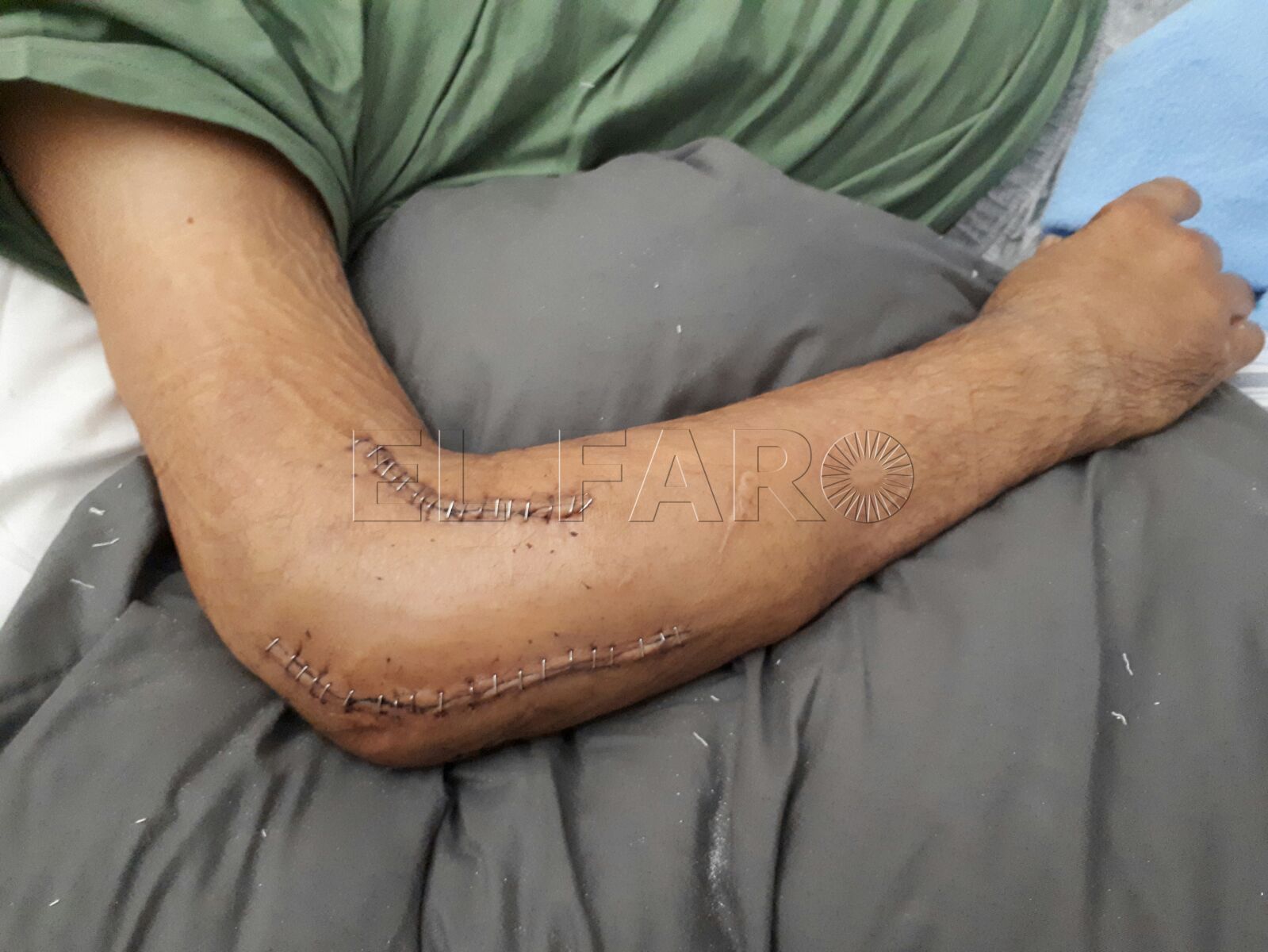 ismael-dedarbi-policia-accidente-3