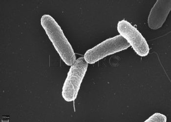 salmonella-virus-microscopio