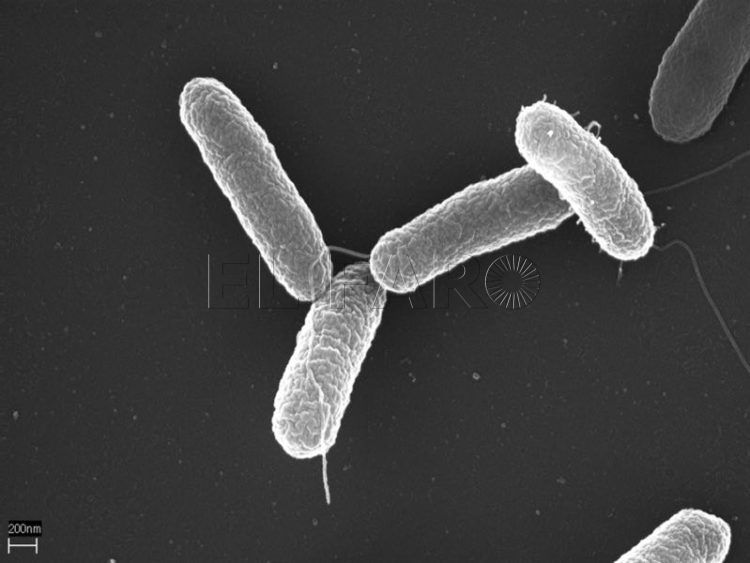 salmonella-virus-microscopio