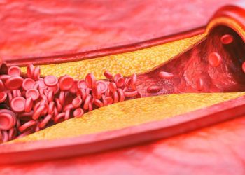 RIESGO CARDIOVASCULAR 2