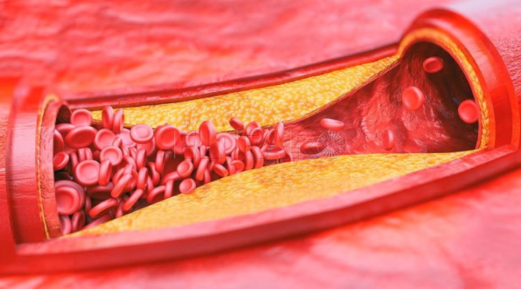 RIESGO CARDIOVASCULAR 2