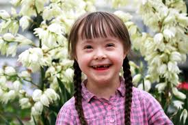 dia-sindrome-down-opinion-3