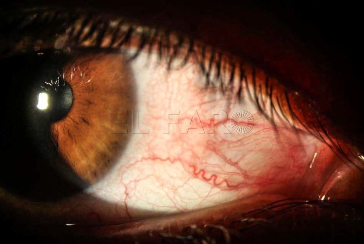 ojo