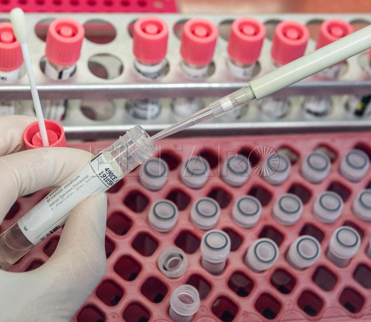 PCR-prueba-coronavirus