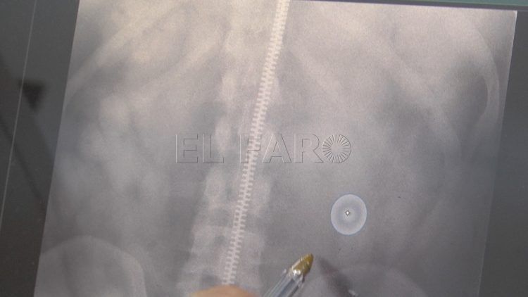 radiografia-guardia-civil-drogas