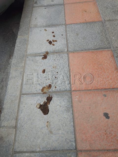 Heces 5