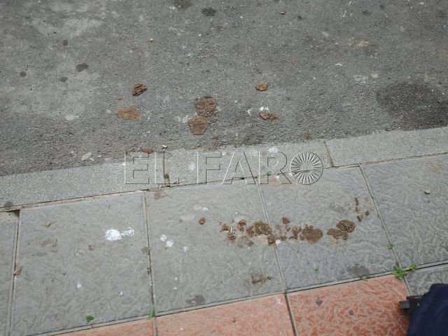 Heces 7
