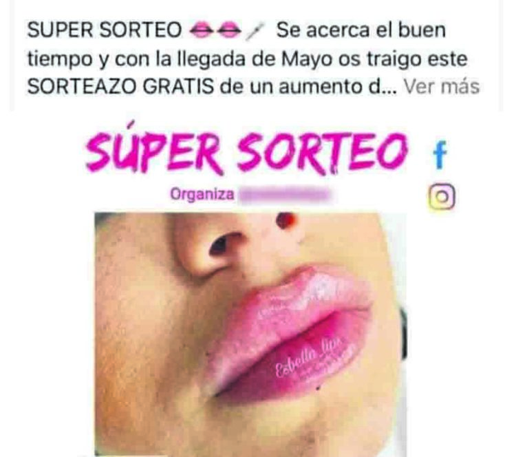 estafa-aumento-labios-cursos-estetica