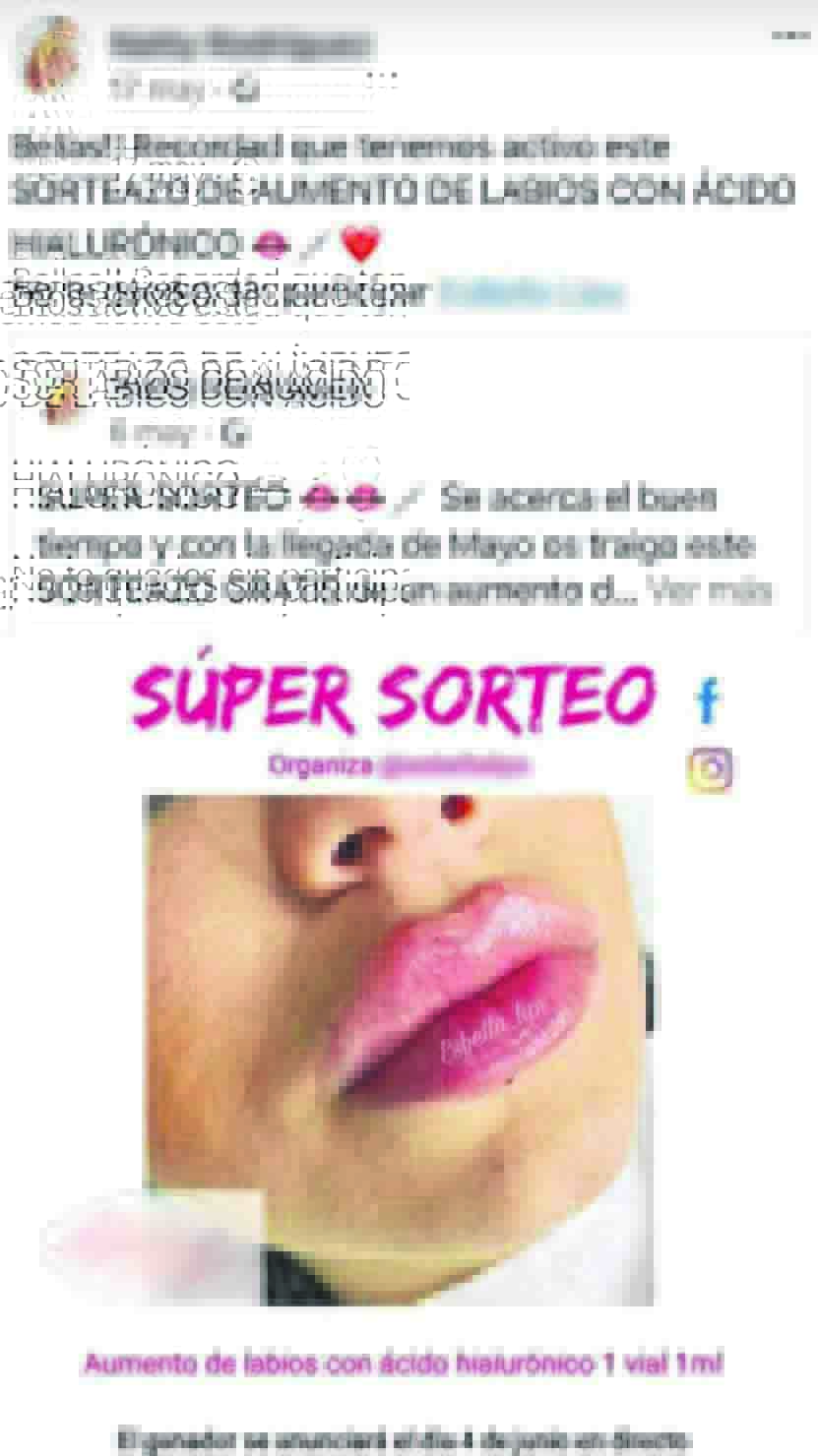 estafa-aumento-labios-cursos-estetica-anuncio