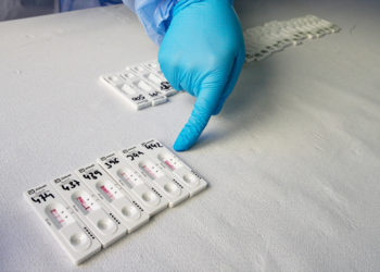test-antigenos-positivos