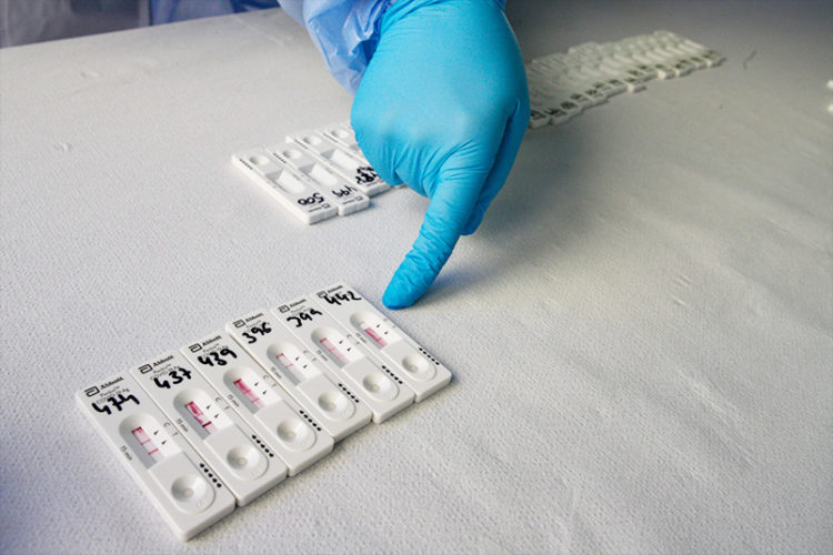 test-antigenos-positivos