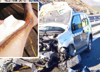 guardia-civil-accidente-pierna
