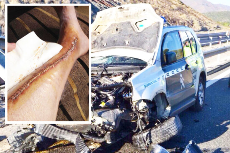 guardia-civil-accidente-pierna