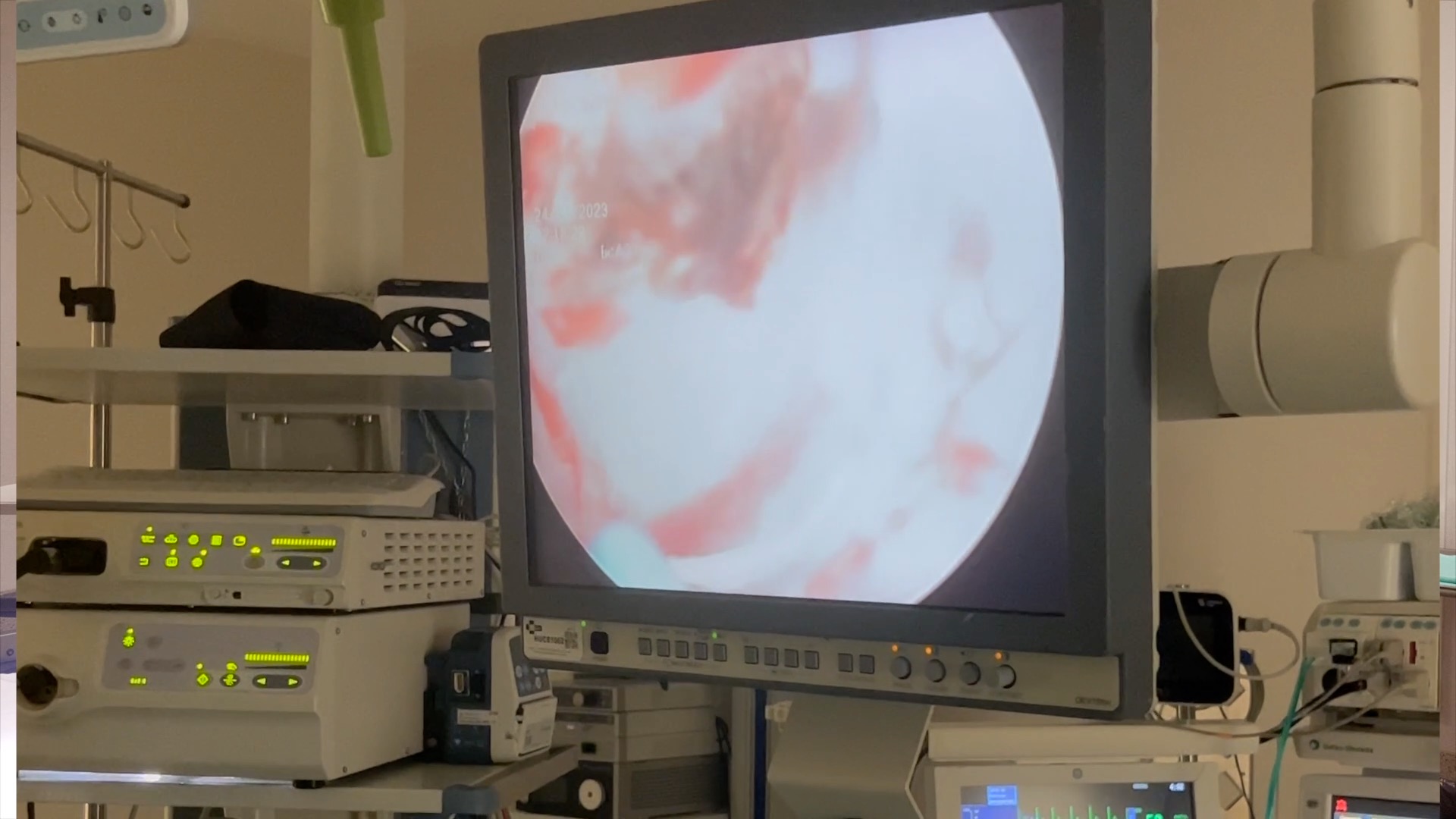 cirugia-servicio-urologia-ingesa-tecnicas-innovadoras-5