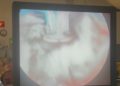 cirugia-servicio-urologia-ingesa-tecnicas-innovadoras-6