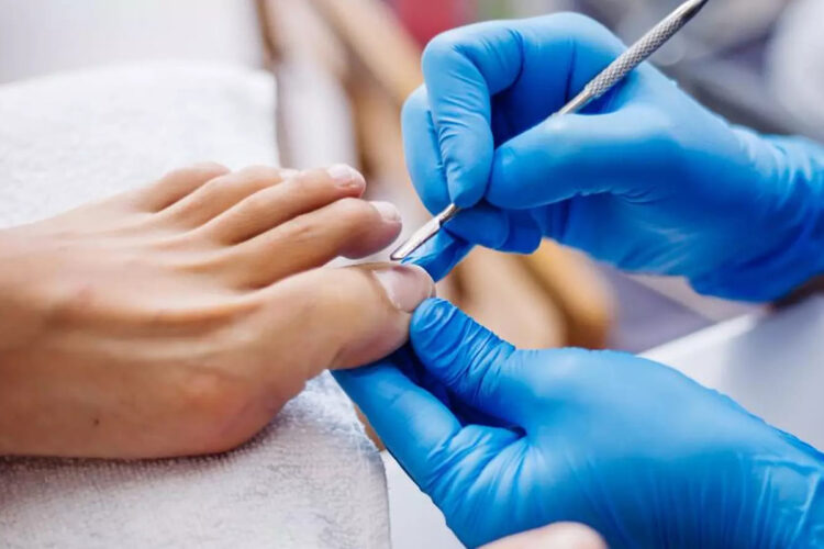 pie-diabetico-seria-complicacion-diabetes-001