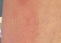 sin-fecha-cita-dermatologia-octubre-001