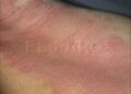sin-fecha-cita-dermatologia-octubre-003